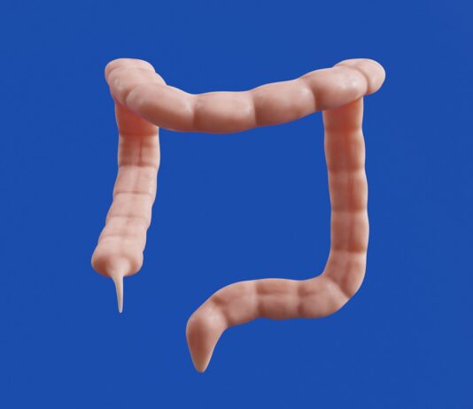 장을 깨우는 3가지 리셋 음료 루틴 The image shows a 3D model of a colon.