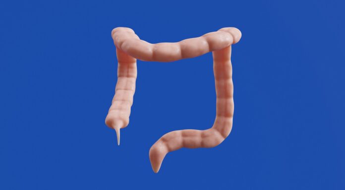 Photo by Aakash Dhage The image shows a 3D model of a colon.